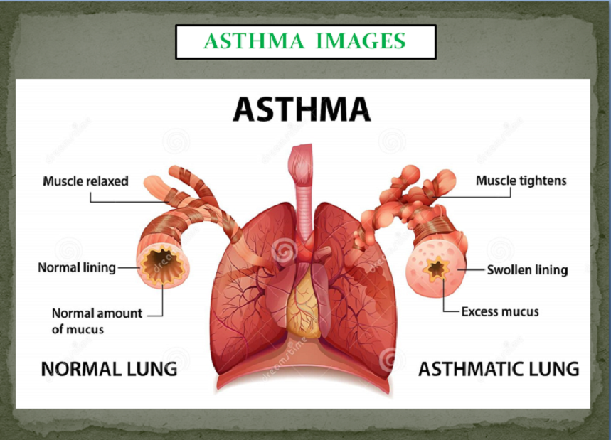 ASTHMA PACKAGES