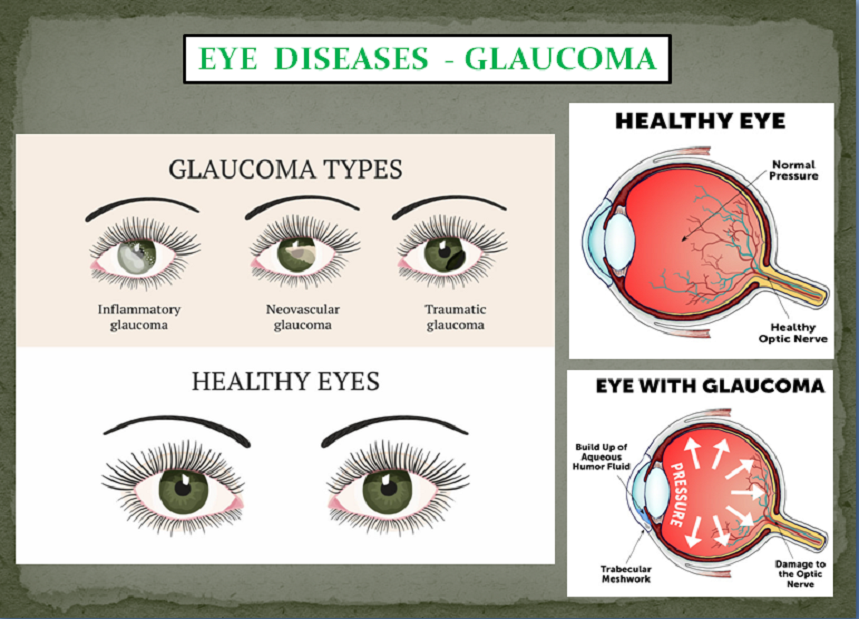 EYE PROBLEMS PACKAGE