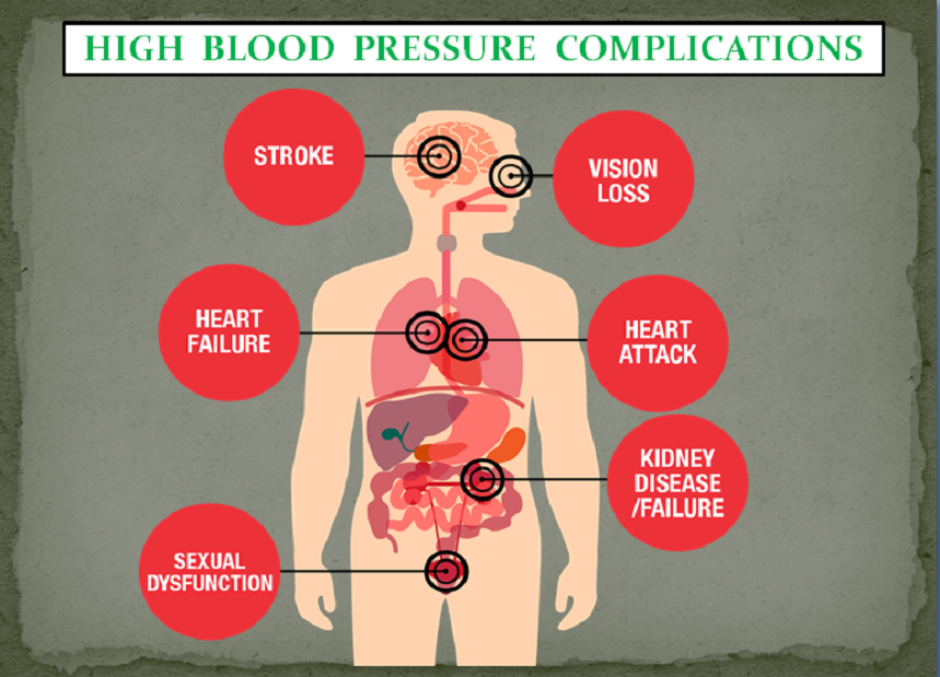 HIGH BLOOD PRESSURE PACKAGE